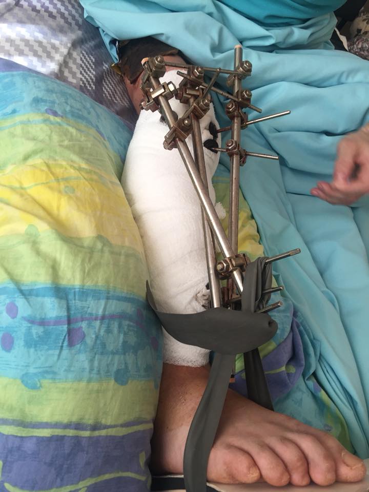 "Новый борт с ранеными": волонтер призвала помочь бойцам в киевском госпитале