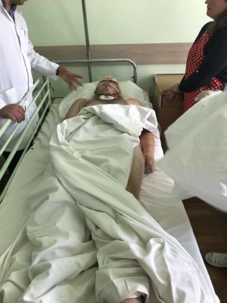 "Голими руками обмацували рани": під Тернополем розгорівся скандал через п'яних лікарів (фото)