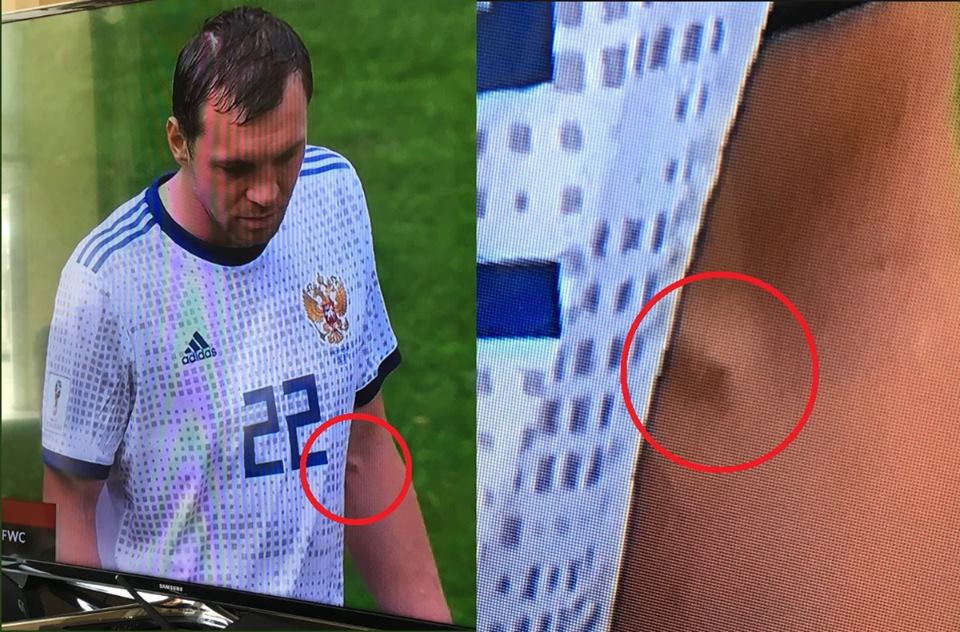 "Слід від свіжої ін'єкції": гравці збірної Росії запідозрили у вживанні допінгу (фото)