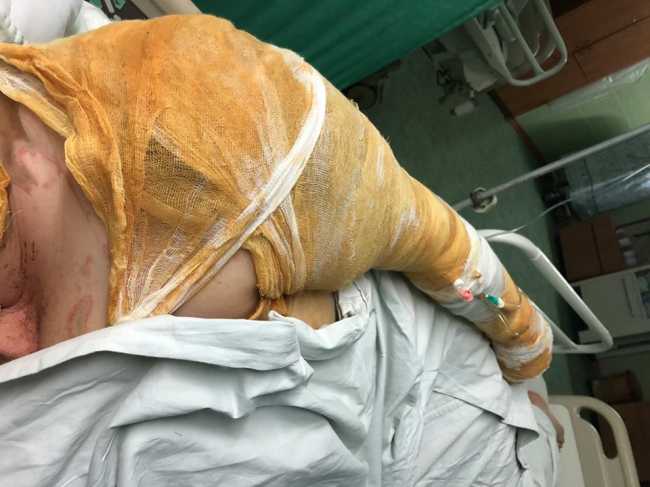 Нападение на чиновницу в Херсоне: пострадавшая рассказала о происшествии (фото)