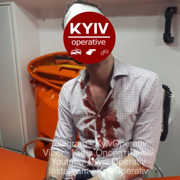 "Видимо, "белочка": в сети рассказали о нападении пьяного киевлянина с саблей на молодого человека