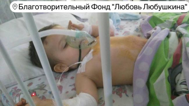 В Одессе двухлетний малыш выпал из окна многоэтажки