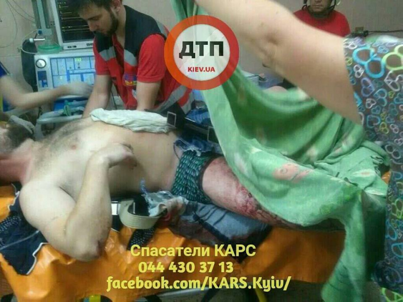 "Пытался перелезть через забор": в Киеве мужчина "накололся" на штыри (фото)