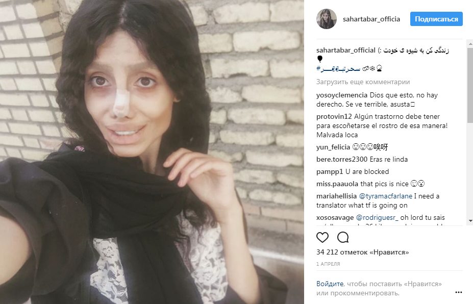 Стало известно, как выглядела до операций подражательница Джоли