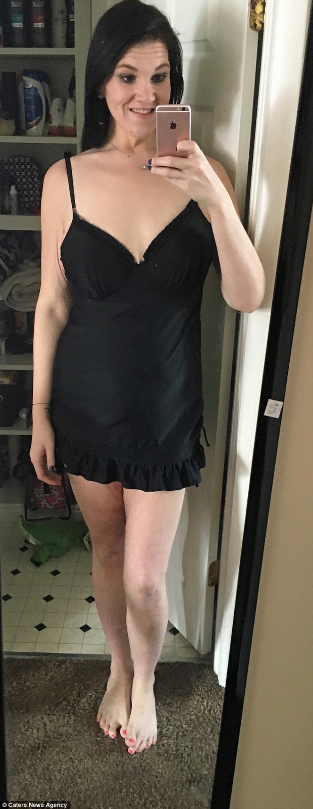 Дівчина, яка важила 188 кг, після схуднення зіткнулася з новою проблемою