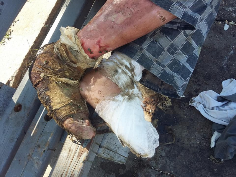 Необхідна допомога: у центрі Миколаєва вмирає чоловік