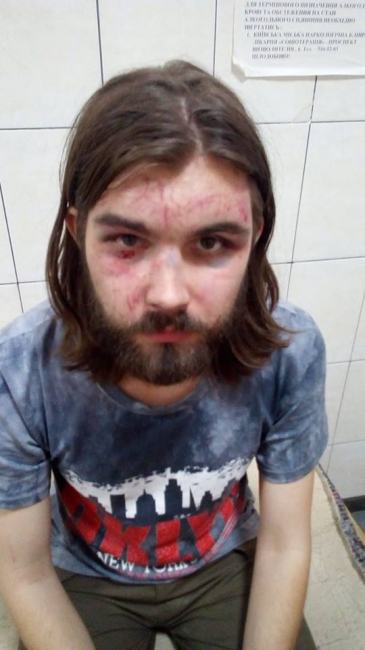 "Под носом у полиции?": в сети высказались о поджоге магазина и избиении продавца в Киеве (фото пострадавшего)