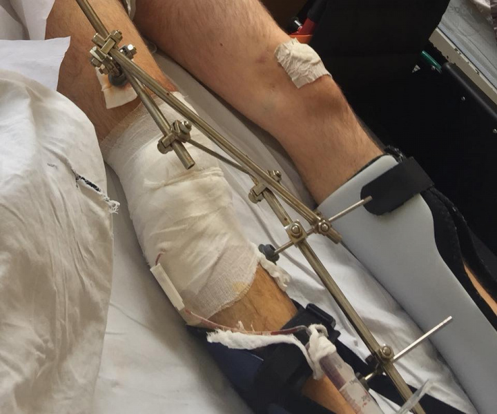 "Война продолжается": волонтер сообщила о поступлении раненых в киевский госпиталь и призвала помочь