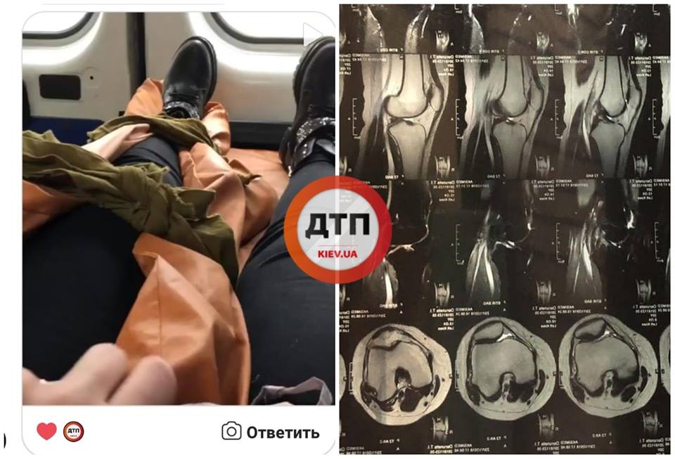 "Навіть не зупинився": маршрутник "протягнув по асфальту" пасажирку