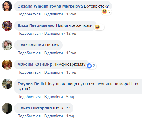 Пухлина або ботокс: знімок Путіна на Валаамі спантеличив мережу