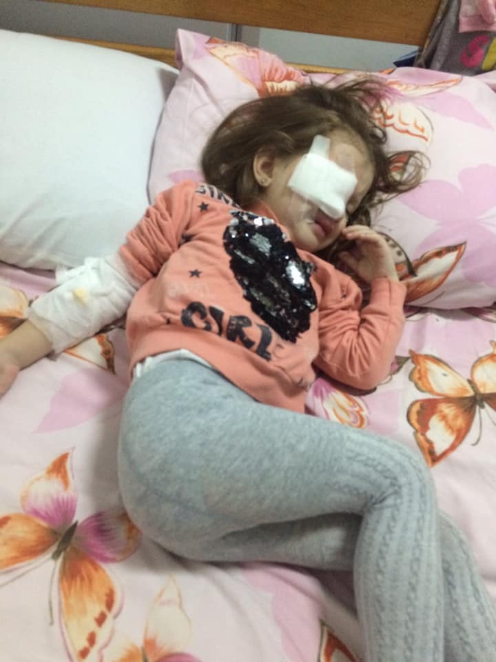 Прокололи око в садку: інцидент отримав продовження