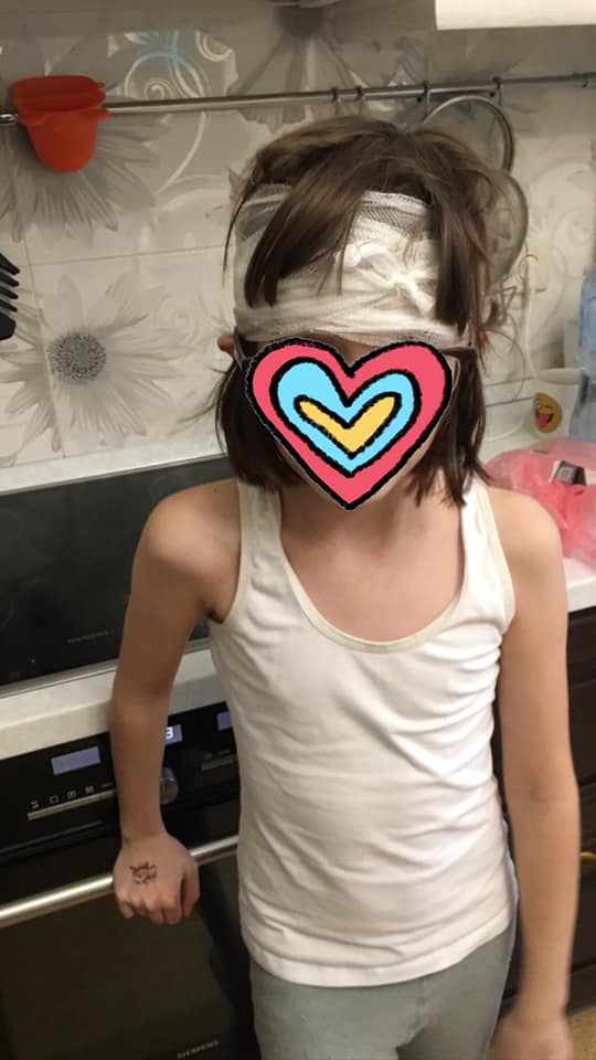 Скорую не вызвали: в школе Киева ребенок получил тяжелую травму головы