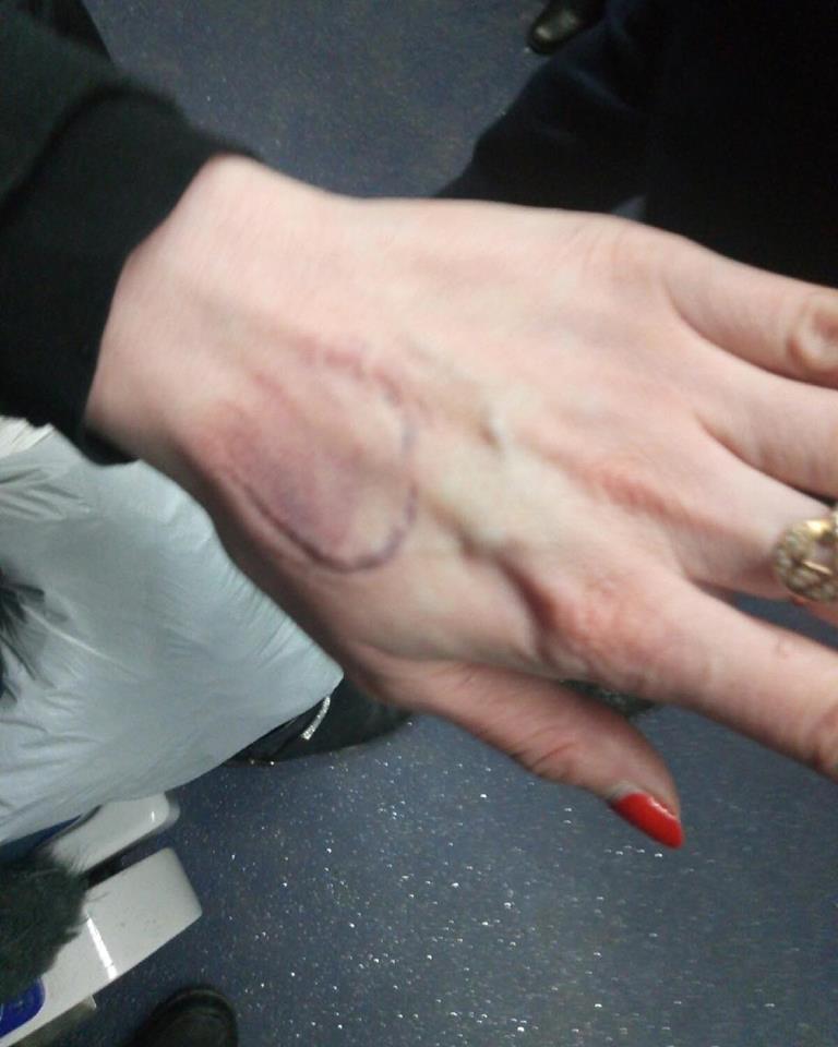 Она еще жива? В харьковском метро избили женщину-попрошайку (видео)