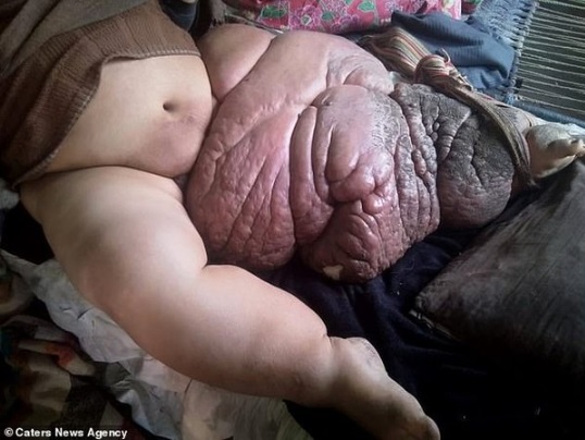 Чоловік благає відрізати йому ногу вагою 150 кілограмів (фото 18 +)