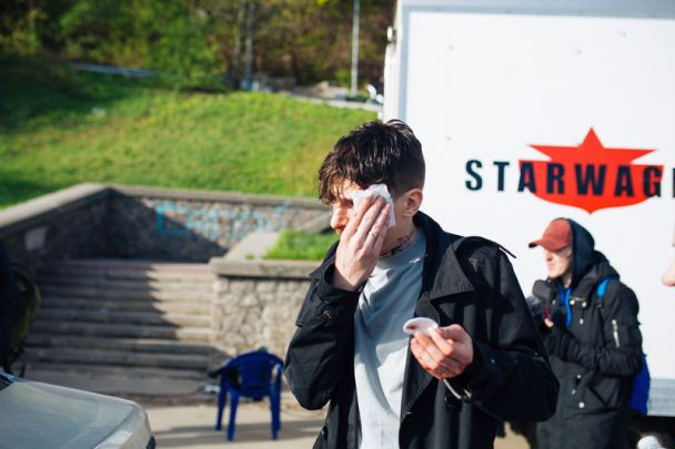 Позитив из "Время и Стекло" серьезно травмировался на съемках клипа (фото)