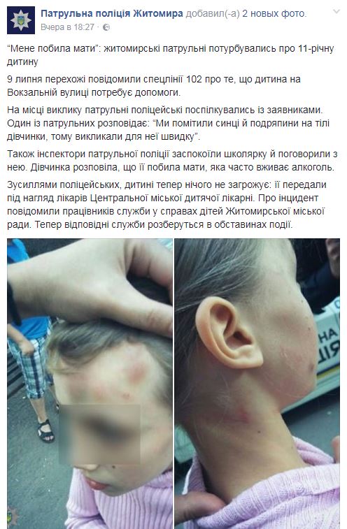 В Житомире пьяная женщина избила 11-летнюю дочь