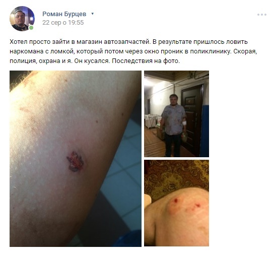 Российского Ди Каприо укусил наркоман