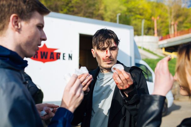 Позитив из "Время и Стекло" серьезно травмировался на съемках клипа (фото)