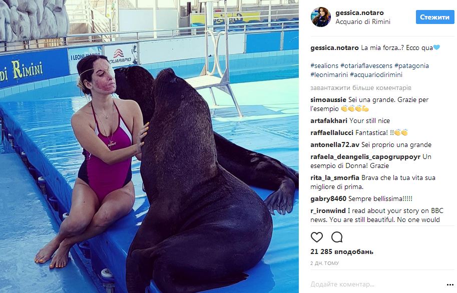 Італійська модель, якій плеснули в обличчя кислотою, повернулася до роботи