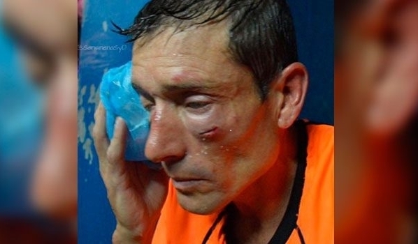 Украинского футболиста, сломавшего челюсть судье, посадили в тюрьму