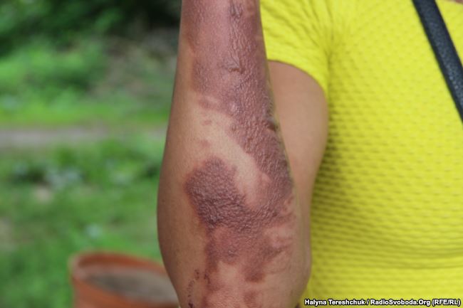 &quot;Нас палили и били&quot;: ромы из Тернополя рассказали, как громили их табор