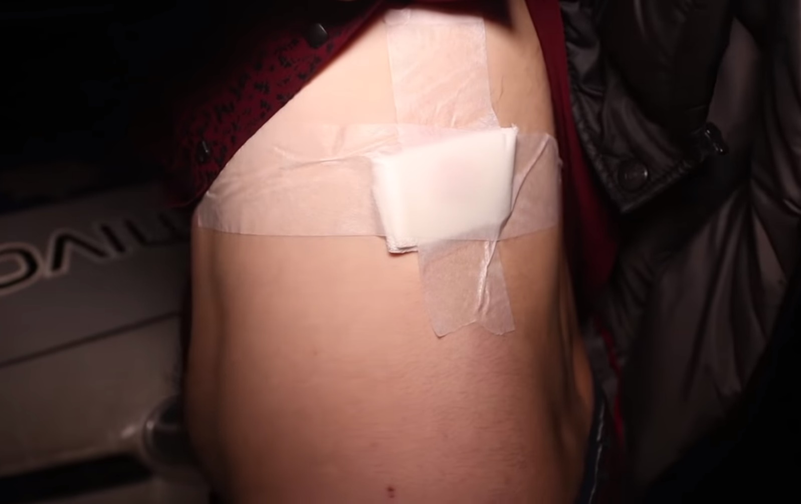 &quot;Межнациональный конфликт&quot;: в Киеве мужчина получил пулю из-за лезгинки