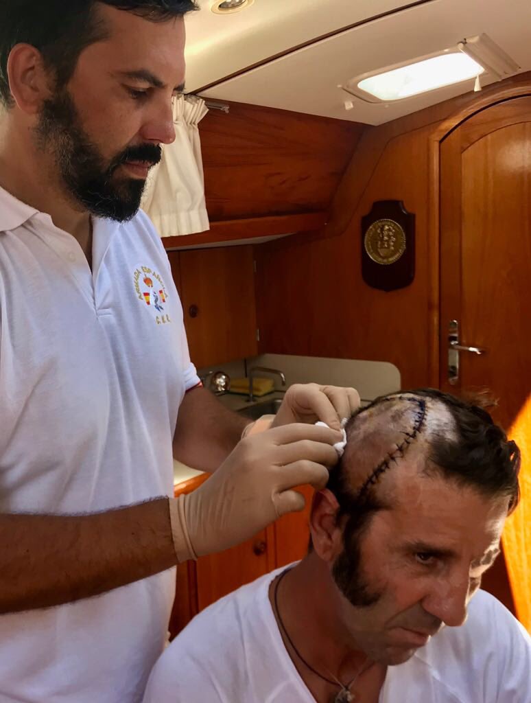 Бык снял часть скальпа со знаменитого матадора: видео не для слабонервных