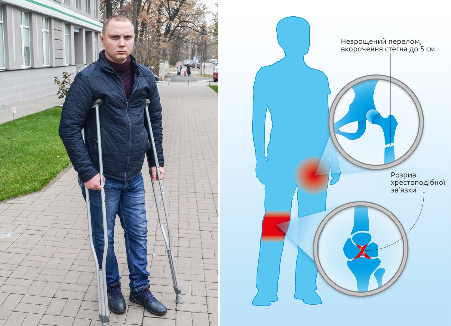 24-річний український боєць потребує термінової допомоги