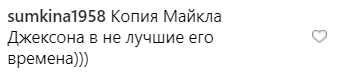 Что ты делаешь с лицом? Ани Лорак снова стала объектом насмешек