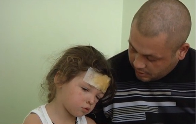 Поджог дома бойца АТО: медики борются за жизнь жены и дочери воина