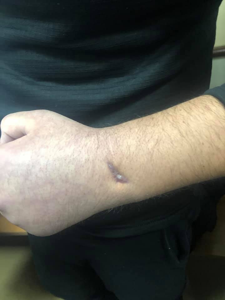 &quot;Пальцы не сгибаются&quot;: адвокат рассказал о здоровье военнопленного моряка