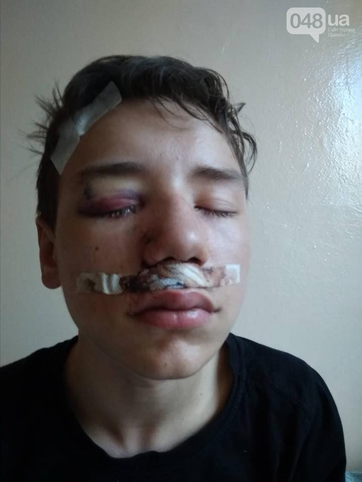 Може втратити око: в одеському супермаркеті хлопчик врізався в скляні двері (фото)