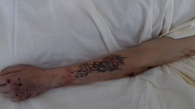 "Не было ни документов, ни телефона": медики просят опознать пострадавшую в ДТП под Киевом (фото)