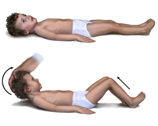 8 ознак менінгіту. Це повинні знати всі батьки!