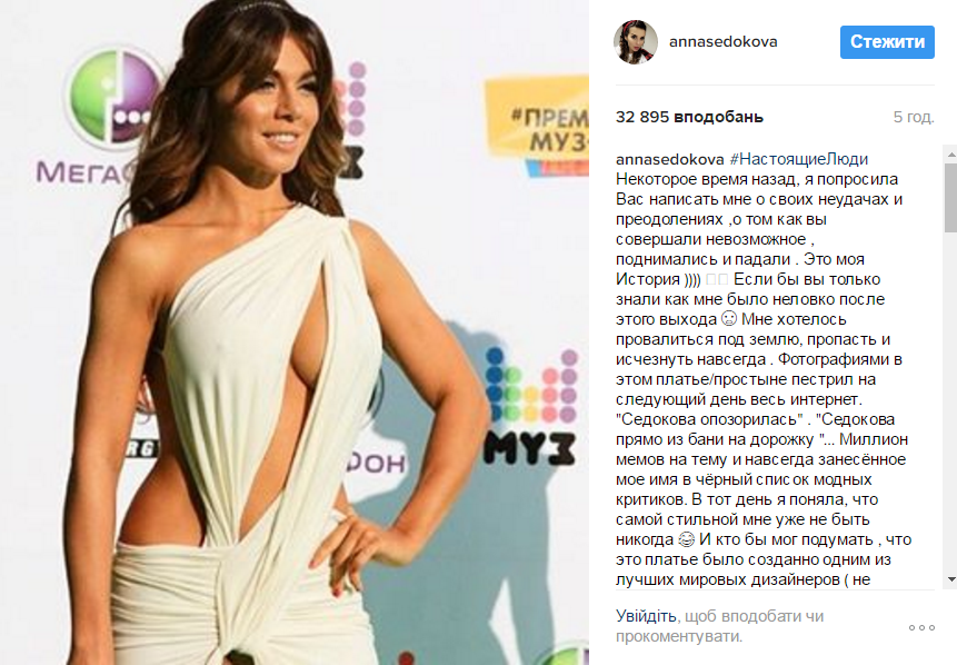 Анна Седокова показала самый большой позор в своей жизни