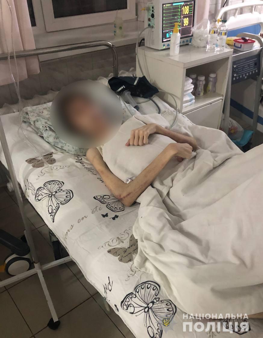 В Одесі батько довів сина до крайнього виснаження, практикуючи "духовне лікування" (відео)