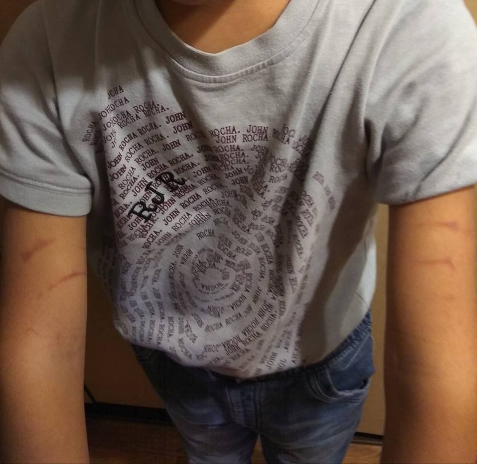 Вчитель тягнув за руки: школяр прийшов додому зі слідами побоїв