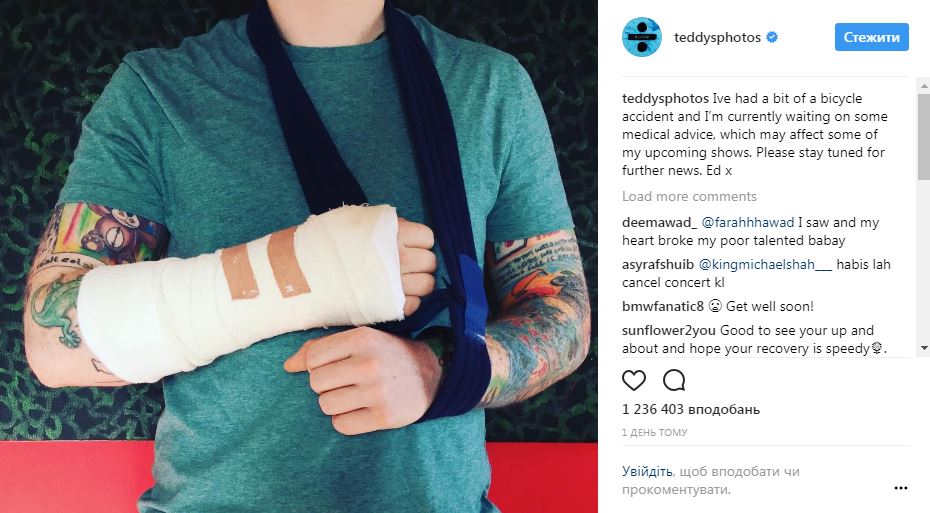 Известного британского певца сбила машина