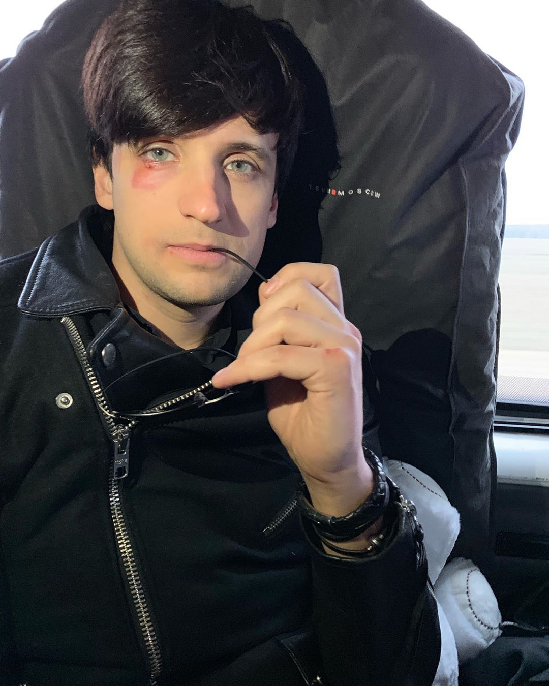 Звезда Евровидения и сторонник &quot;русского мира&quot; получил фингал на гастролях (фото)