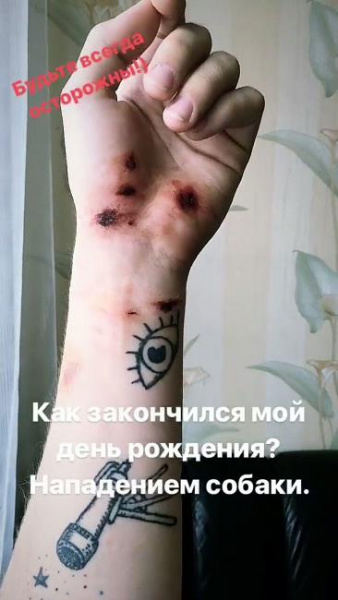 На представителя Украины на Евровидении 2018 напали в Лиссабоне (фото)