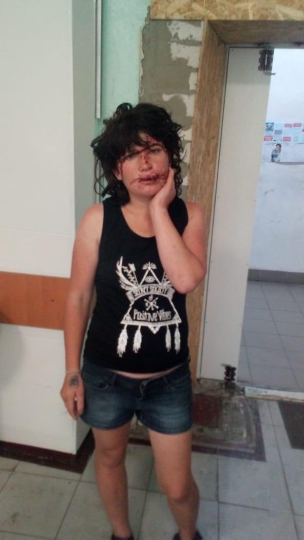 У центрі Дніпра чоловік жорстоко побив жінку ногами по голові