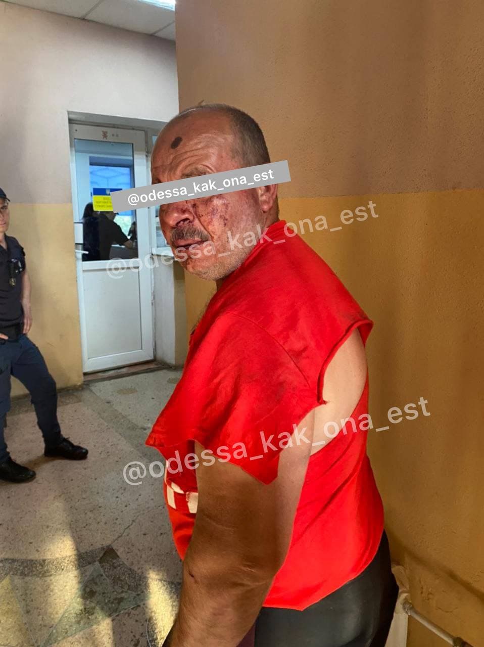 В Одесі влаштували самосуд над чоловіком, який намагався затягнути дівчинку з ДЦП у парк