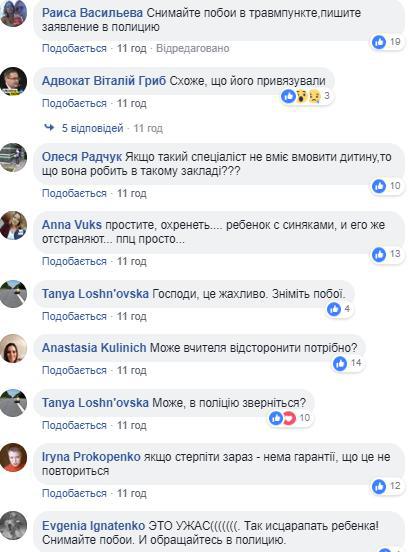 Вчитель тягнув за руки: школяр прийшов додому зі слідами побоїв