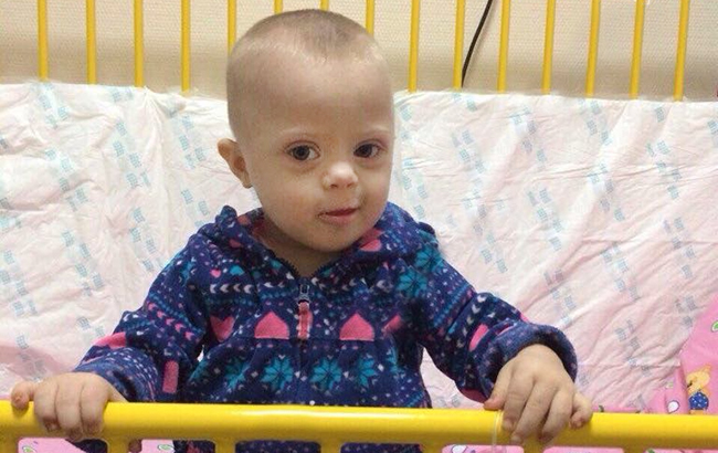 Двойной порок сердца и рак: украинцев просят помочь спасти жизнь двухлетней Вари
