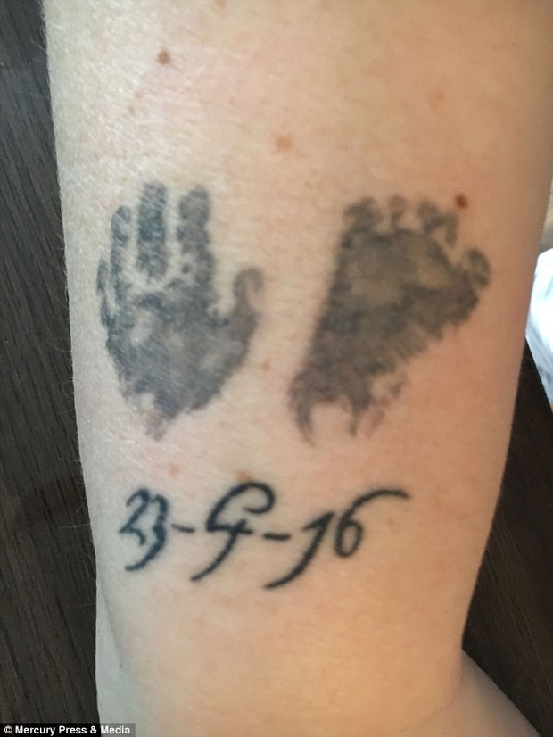 Лікарі зберегли життя маленькій дівчинці недоношеною