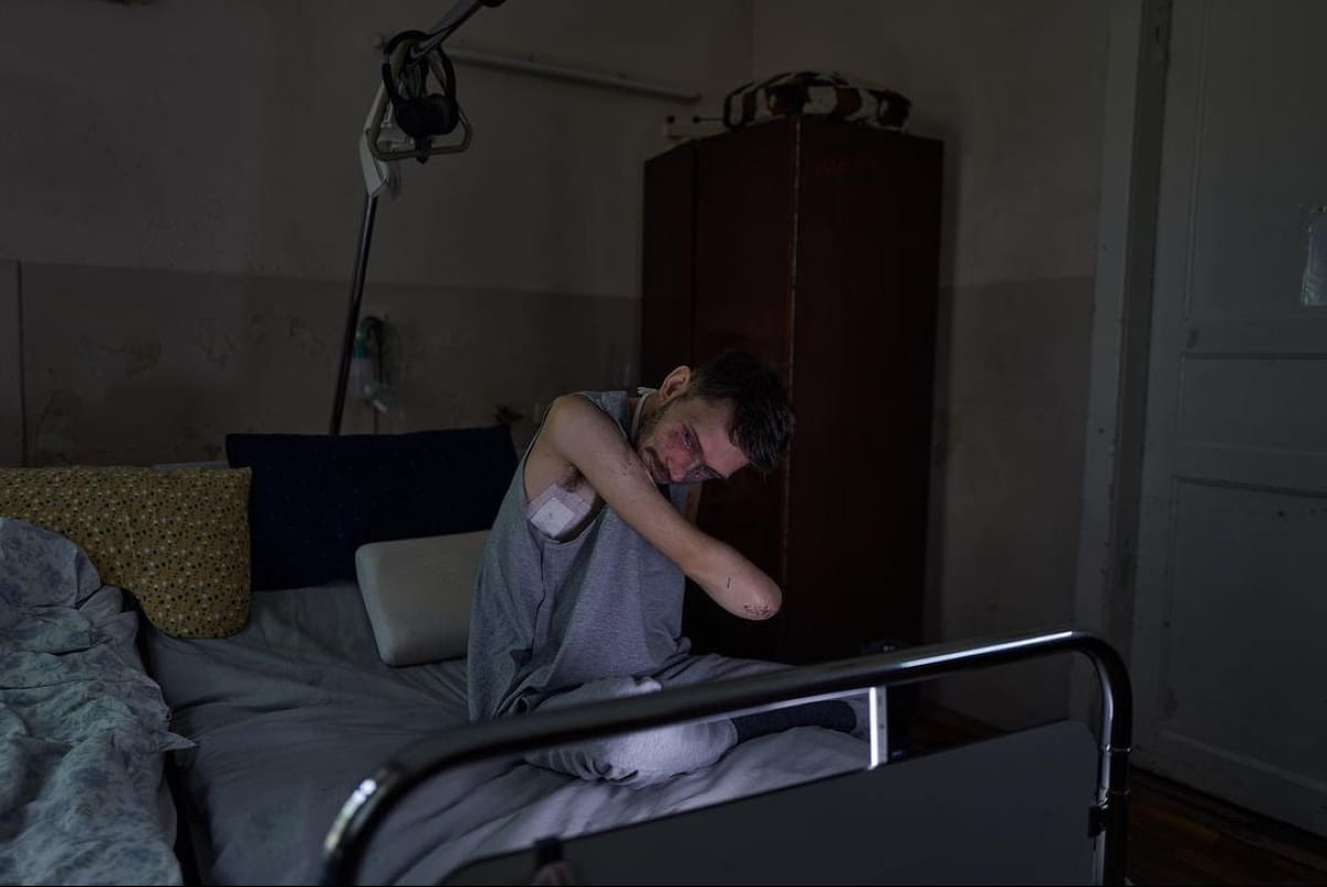 Втратив руки, зір і частково слух. Дружина пораненого воїна розчулила історією свого чоловіка