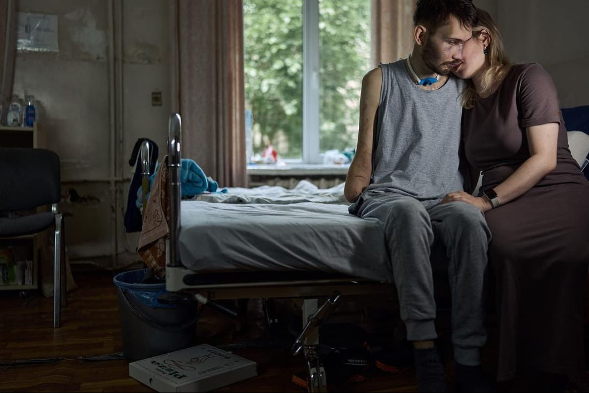 Втратив руки, зір і частково слух. Дружина пораненого воїна розчулила історією свого чоловіка