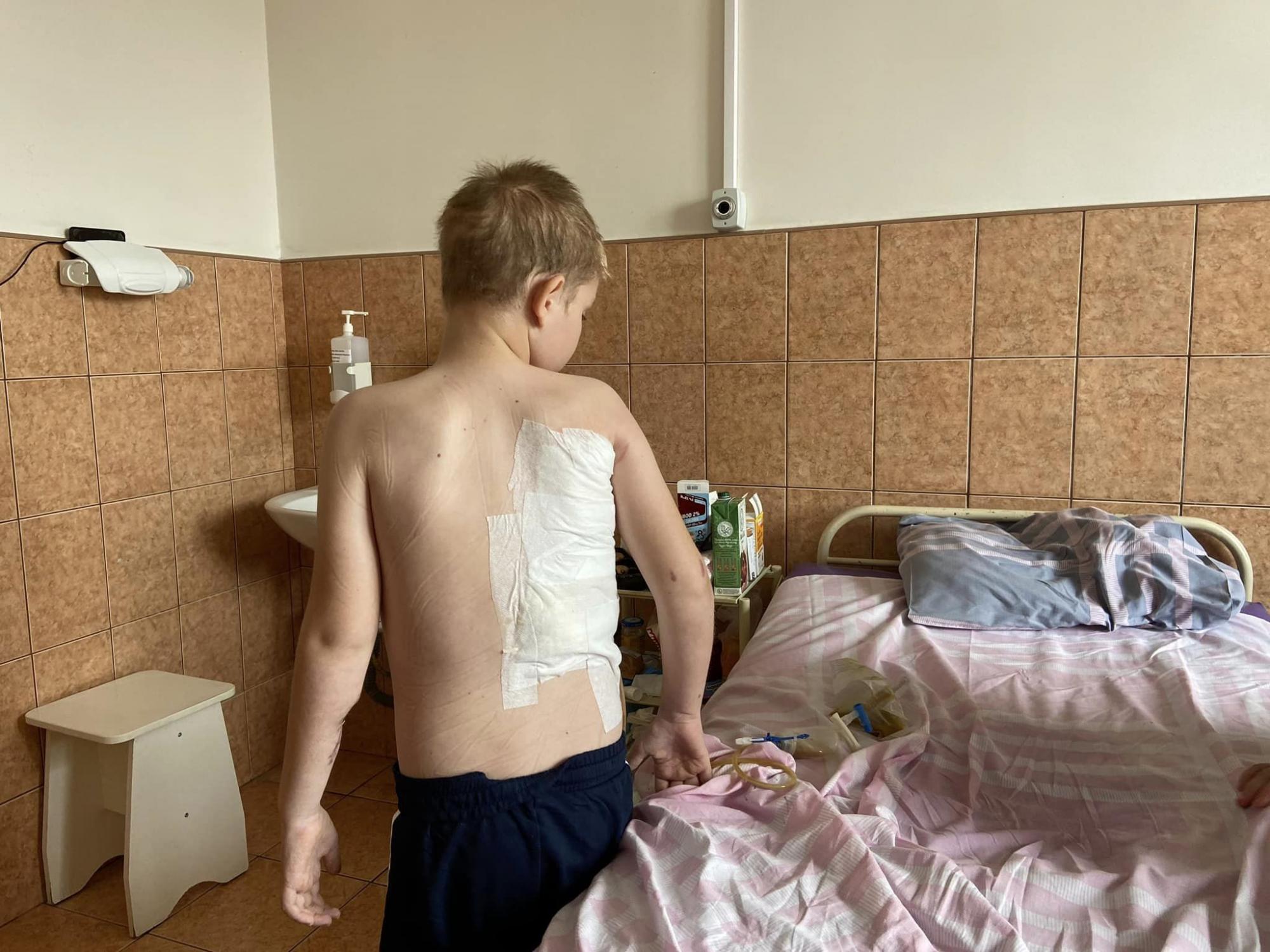 Львовские врачи поставили на ноги 11-летнего Артема из Харькова, который пережил кому и 8 операций