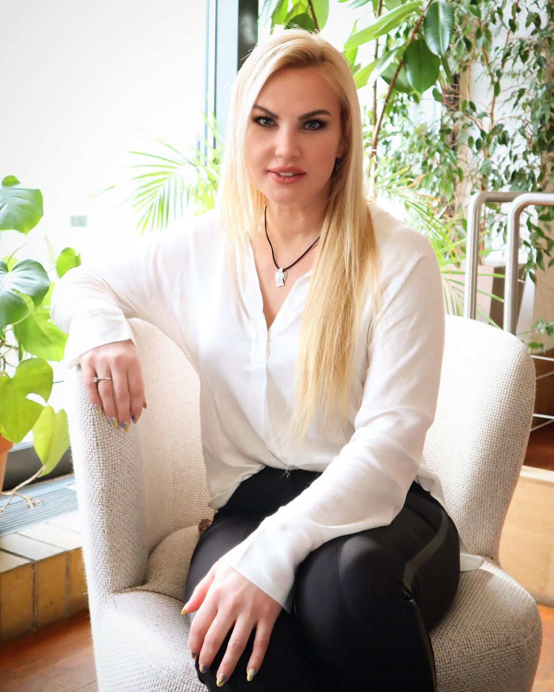 Камалия впервые честно рассказала о "пластике" лица