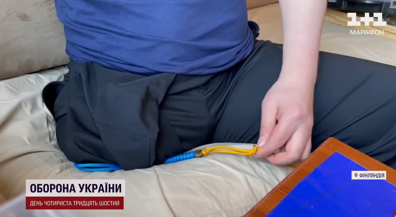 "Боялися, що розсиплеться": лікарі врятували бійця ЗСУ з опіками, для яких немає класифікації